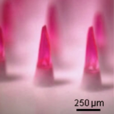SEM-изображение растворимых микроигл (250 мкм). Используются в трансдермальной доставке активных компонентов.